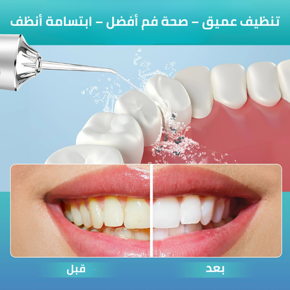 جهاز تنظيف الأسنان بالخيط المائي